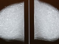 Ask the Doc Your Mammogram Questions