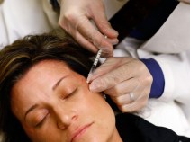 Look Younger With Nonsurgical Treatments