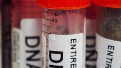 Yale Looking for Clinical Trial Volunteers