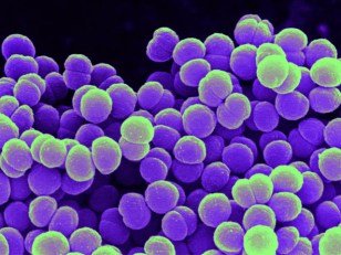 Meet Probiotics: Good Balance in Your Body