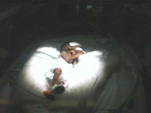 NICU Baby Grows Up to Become NICU Nurse