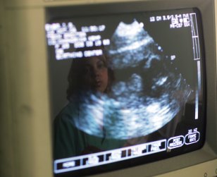 Gov. Considers Banning Fetal Family Photos