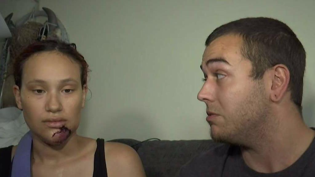 Search on for Dog That Attacked Woman in Plainfield