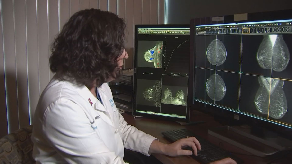 3-D Mammogram Technology Helps Detect Breast Cancer Earlier