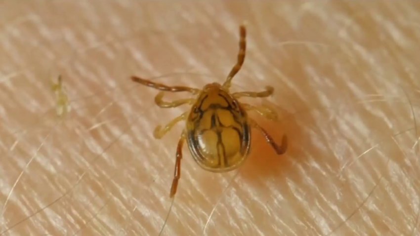 Lyme Disease Shares Symptoms With COVID-19