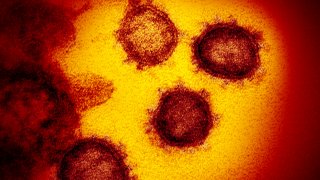 The SARS-CoV-2, the virus that causes COVID-19, or the coronavirus, as seen in this image emerging from lab grown cells. The virus was isolated from a patient from the United States.