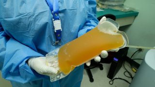 A doctor holds a donation of convalescent plasma from a recovered COVID-19 patient at the Arnulfo Arias Madrid Hospital, in Panama City, Wednesday, May 13, 2020.