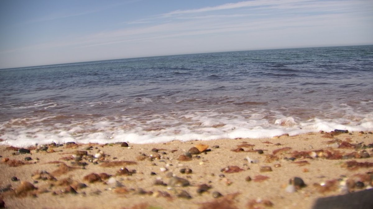 Swimmer’s Itch reported at several Greenwich beaches NBC Connecticut