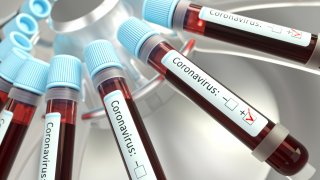 Coronaviruses research, conceptual illustration. Vials of blood in a centrifuge being tested for coronavirus infection.