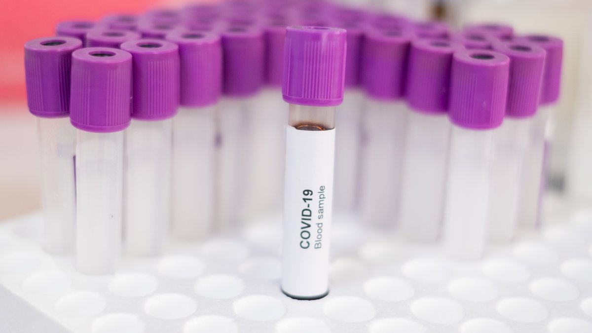 Ellington Reports First Positive Case of Coronavirus NBC Connecticut