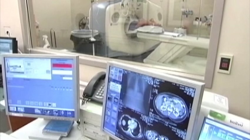 Lung Cancer Screen
