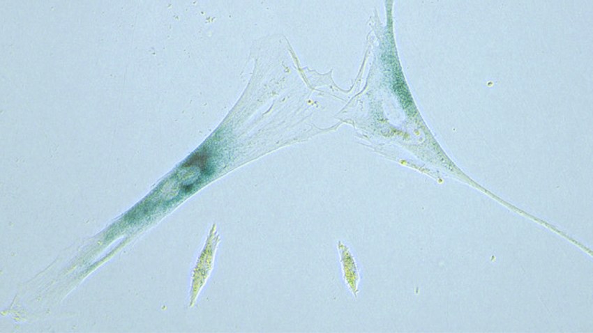 Zombie Cells