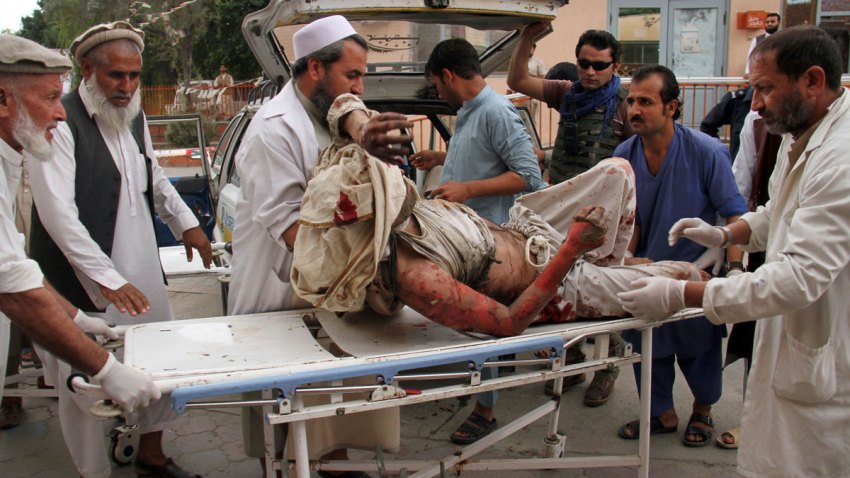 APTOPIX Afghanistan