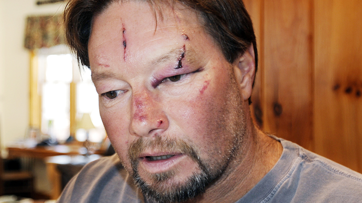 Bobcat Attack