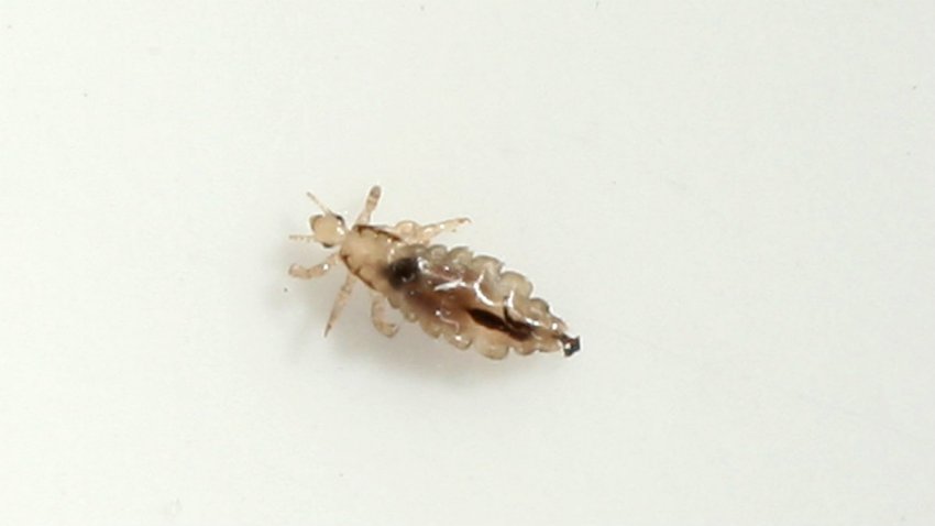 head lice
