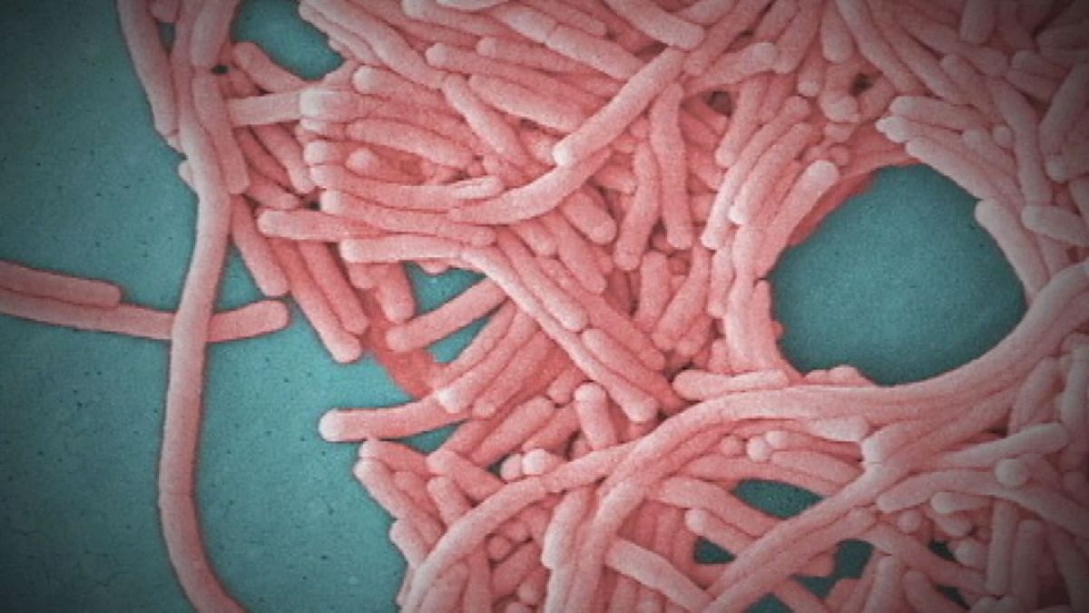 Legionnaires Disease Explained NBC Connecticut
