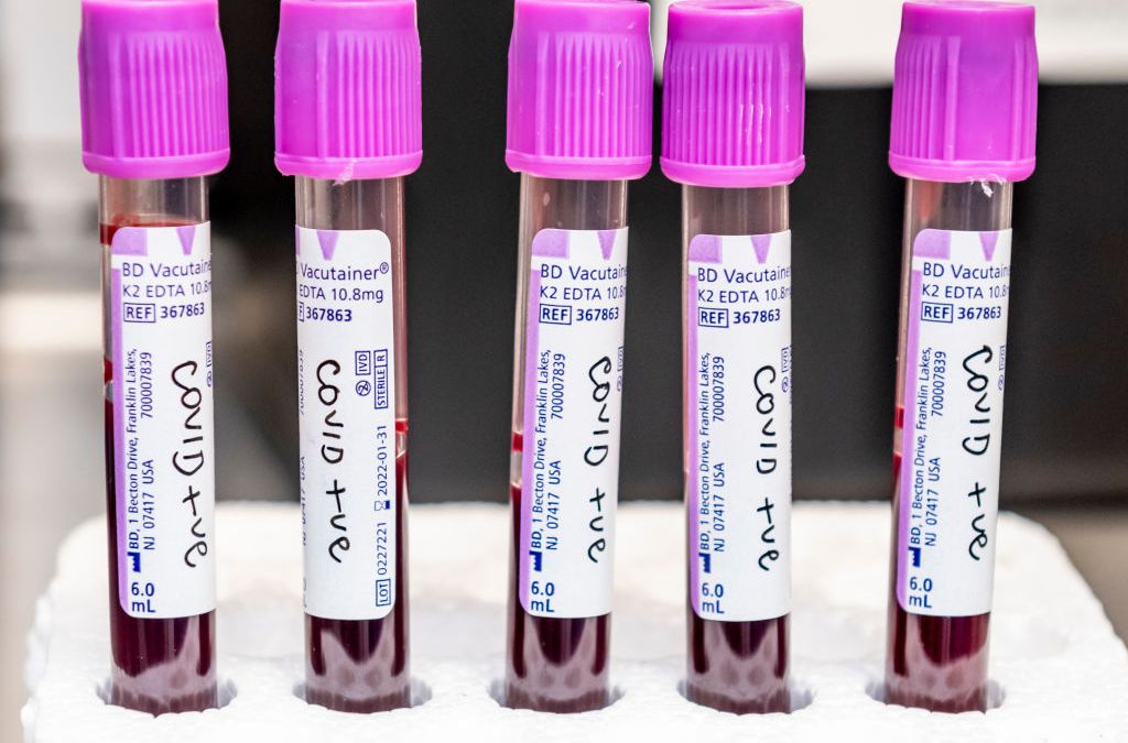 COVID-19 variant from South Africa discovered in Connecticut Resident
