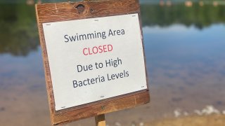 Sign at Gay City State Park says it is closed for swimming due to bacteria levels.
