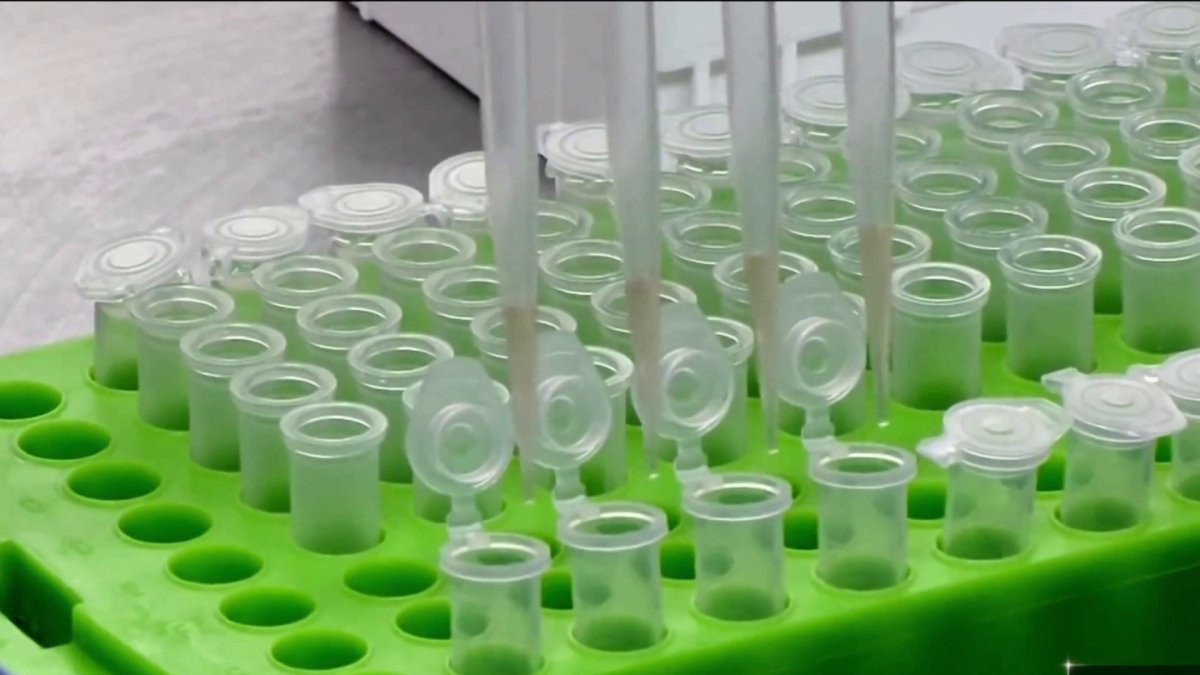 Q&A How a Test Created At Yale Helps The Fight Against Covid19 NBC