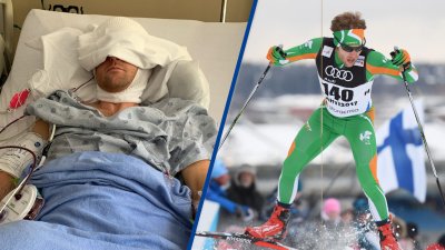 Two Years After Brain Surgery, This Olympic Hopeful Could Compete for Team Ireland
