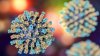 CDC reports first measles death amid confusion over Pennsylvania cases