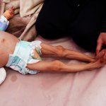 Starvation Rate Is Increasing In War-Torn Yemen