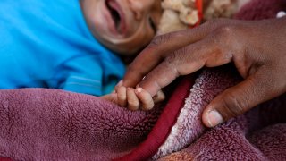 Starvation Rate Is Increasing In War-Torn Yemen