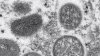 Monkeypox Virus Reaches New England