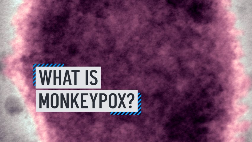 What is Monkeypox?