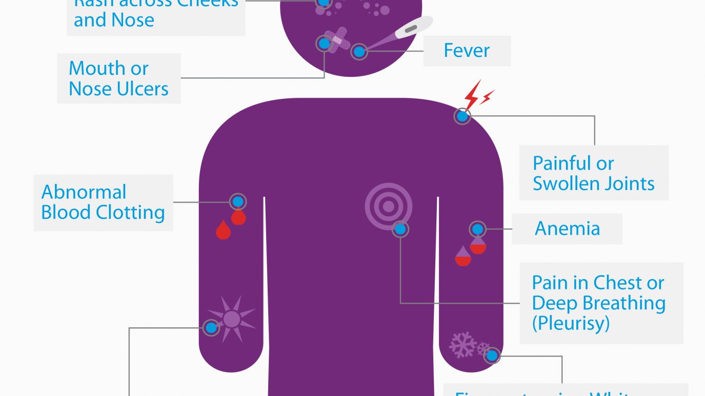 Lu's Rash Bringing Awareness on World Lupus Day – NBC Connecticut