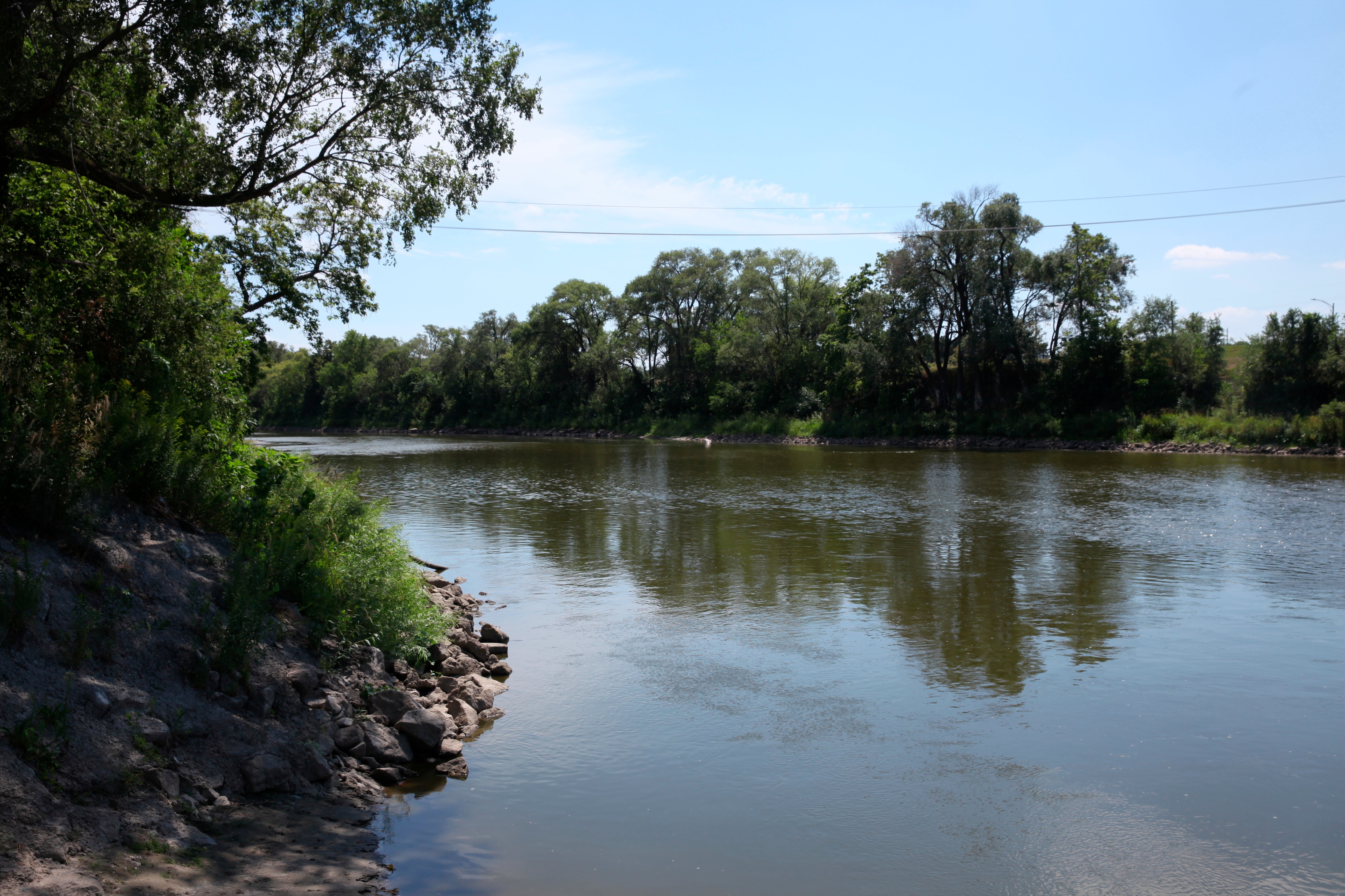 Child Dies From Suspected Case of Brain-Eating Amoeba Infection in Nebraska - Vimarsana News