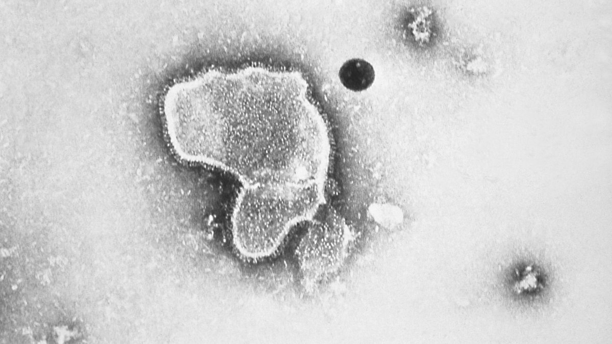 Navigating Spike in Respiratory Illnesses This Thanksgiving - Vimarsana News