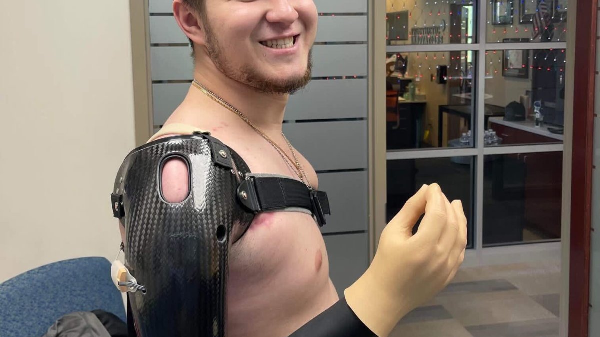 'I Really Want to Go Back to Fight:' A Wounded Ukrainian Soldier Reflects on His Recovery – NBC Connecticut - Vimarsana News