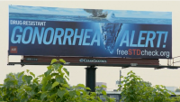 Gonorrhea billboard sparks local curiosity and national attention