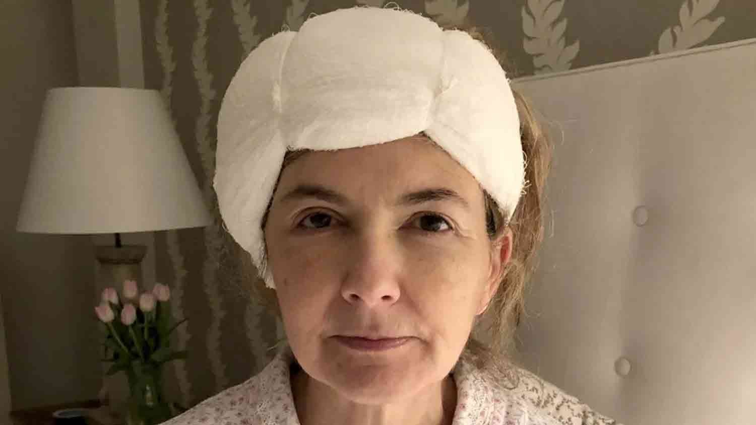 Doctors told me to take nasal spray, eye drops for symptoms. I had an egg-size brain tumor - Vimarsana News