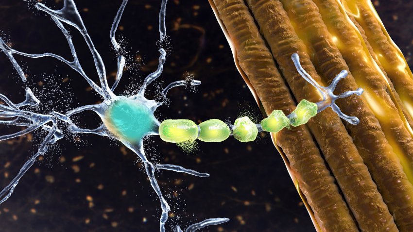 What is ALS?