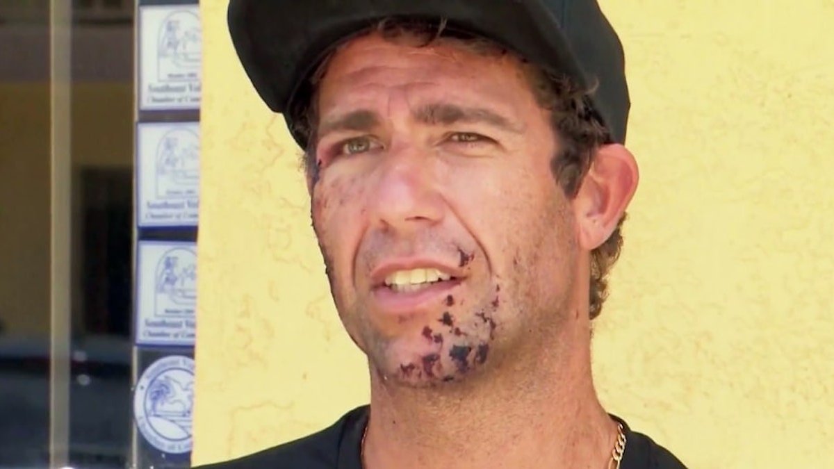 Surfer recalls getting bit in the face by shark at Florida beach – NBC Connecticut - Vimarsana News