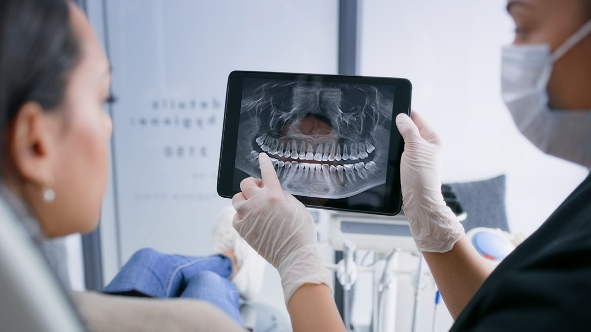 New ADA rec says lead aprons aren't needed for dental X-rays – NBC Connecticut - Vimarsana News