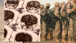 Military Brain Trauma