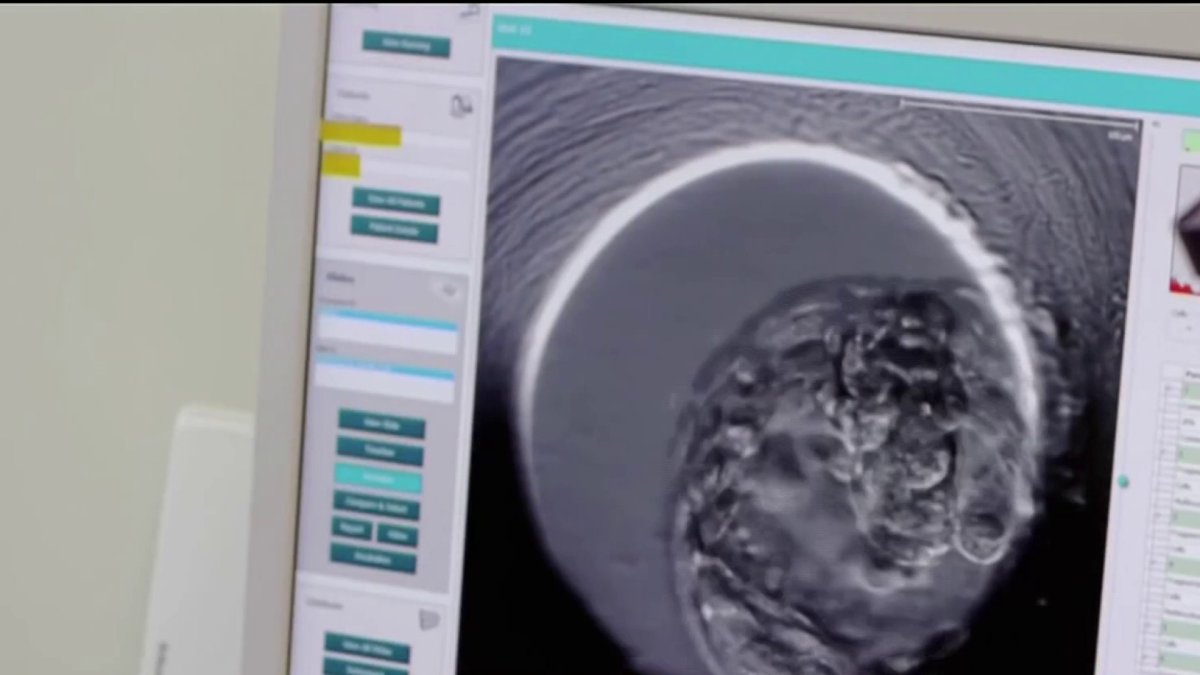 The procedure that could delay or prevent menopause for a decade or