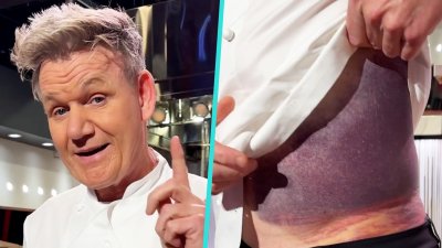Gordon Ramsay reveals massive bruise after bike accident