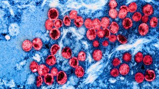 Colorized transmission electron micrograph of mpox virus particles (red) found within an infected cell (blue), cultured in the laboratory.