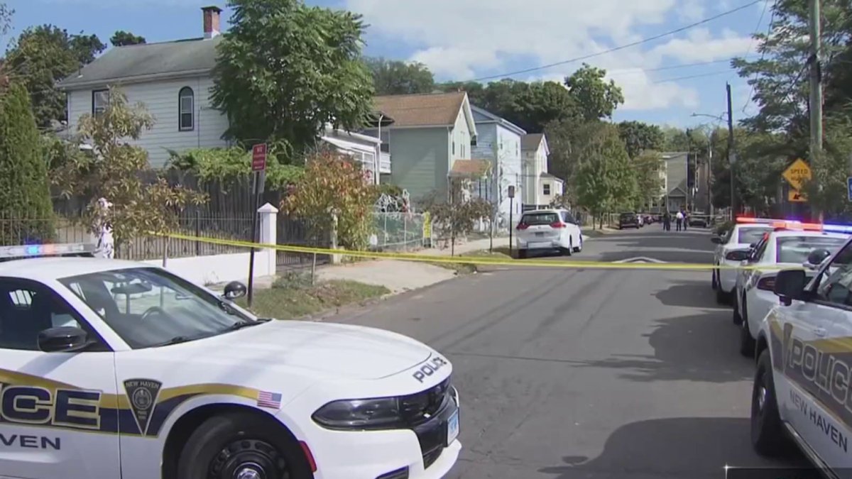 21-year-old man dead after shooting in New Haven – NBC Connecticut