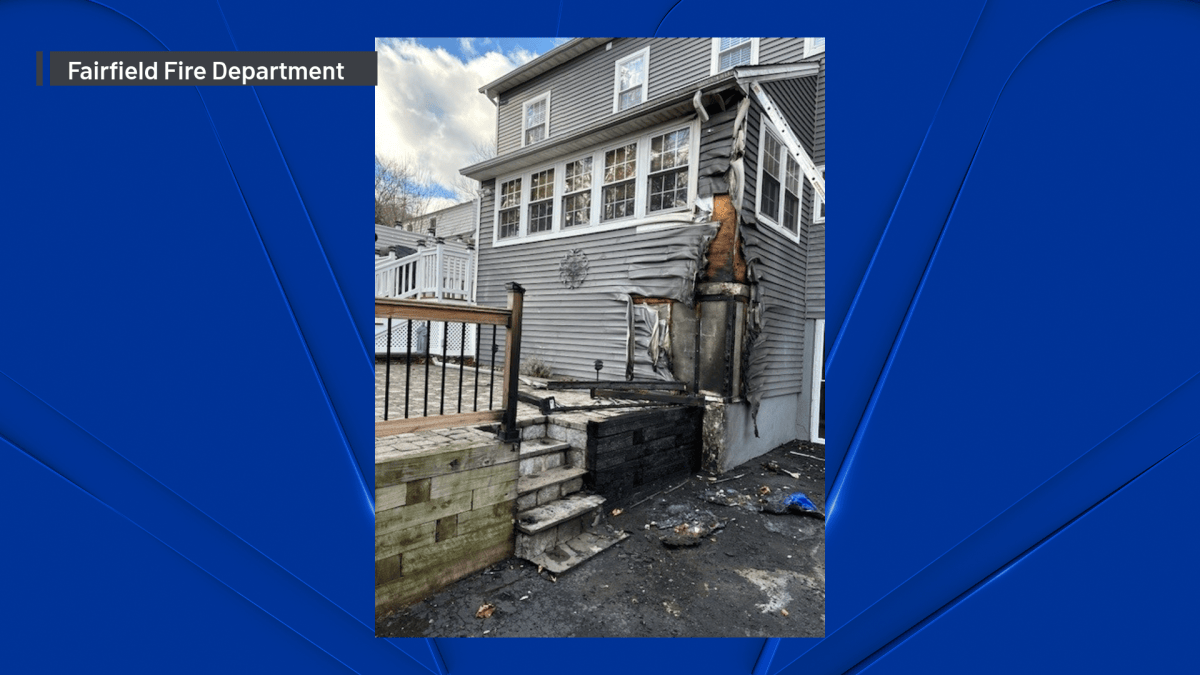 Man suffers burn injury during house fire in Fairfield – NBC Connecticut