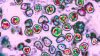 Recent measles case confirmed as third in Connecticut this year, DPH says