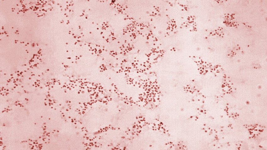 A close up of bacteria.