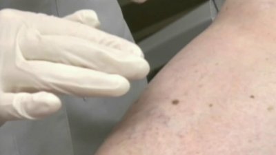 May is Skin Cancer Awareness Month