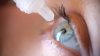 Millions of eye drops recalled nationwide over sterility concerns