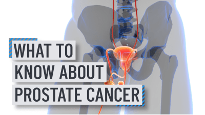 What you need to know about prostate cancer