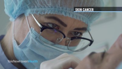Better Health: Skin Cancer with Dr. Austin